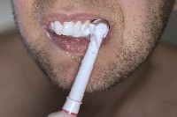 日常生活中需要注意哪些口腔护理问题