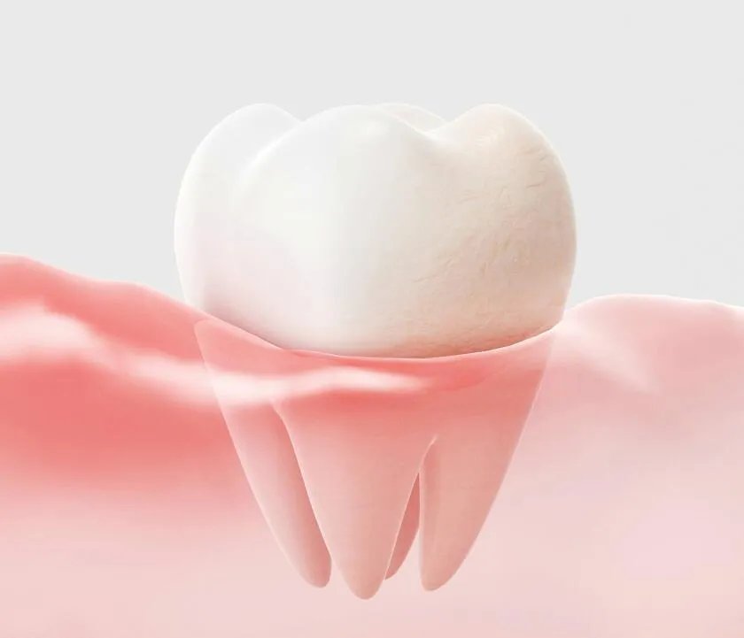 牙龈萎缩的常见原因